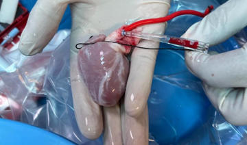 Un hôpital saoudien réalise une transplantation cardiaque sur le plus jeune patient du Moyen-Orient