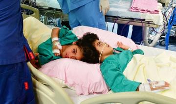 Des chirurgiens saoudiens séparent des sœurs siamoises égyptiennes