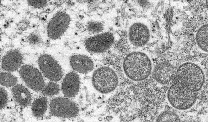 Le nombre de cas de l'épidémie actuelle en dehors de l'Afrique a dépassé les 3 000 dans plus de 40 pays depuis que la variole du singe a été signalé pour la première fois en mai. (Photo, AP)